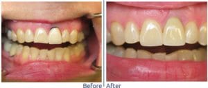 Cosmetic Dentistry