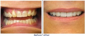 Cosmetic Dentistry