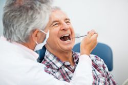 Am I A Candidate For Dental Implants in Marietta Georgia?