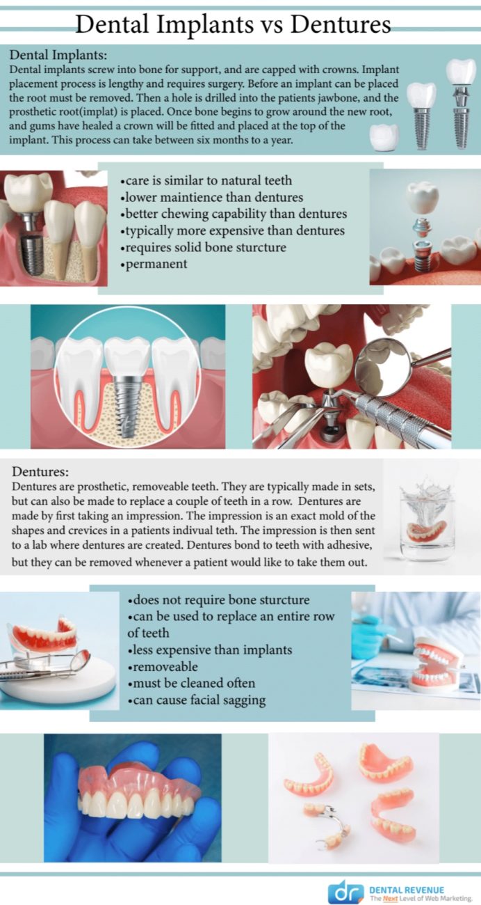 dental implants vs dentures infographic