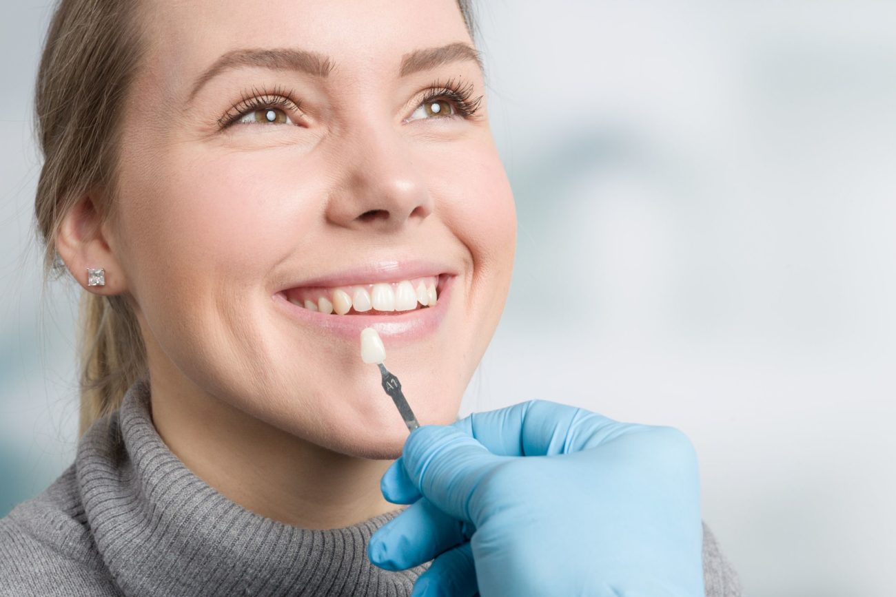 porcelain veneers procedure Marietta Georgia